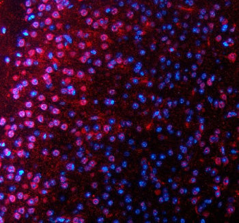 Immunofluorescent staining of SALL2 using anti-SALL2 antibody (red)). SALL2 was detected in a paraffin-embedded section of mouse brain tissue. Heat mediated antigen retrieval was performed in EDTA buffer (pH 8.0, epitope retrieval solution). The tissue section was blocked with 10% goat serum. The tissue section was then incubated with 5 ug/ml rabbit anti-SALL2 antibody overnight at 4oC. Cy3 Conjugated Goat Anti-Rabbit IgG was used as secondary antibody at 1:500 dilution and incubated for 30 min at 37oC.