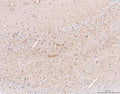 IHC staining of FFPE mouse brain tissue with Aquaporin 4 antibody. HIER: boil tissue sections in pH8 EDTA for 20 min and allow to cool before testing.