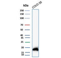 Western blot testing of human COLO-38 cell lysate with MART-1 antibody. Expected molecular weight ~20 kDa with possible doublet.