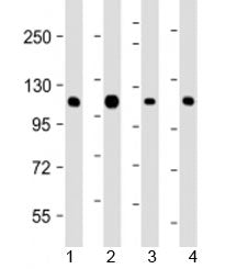 Western blot testing of human 1) K562, 2) Jurkat, 3) Raji and 4) SK-BR-3 cell lysate with CBL antibody at 1:2000. Expected molecular weight: 100-120 kDa.