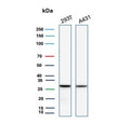 Western blot testing of human 293T and A431 cell lysate with recombinant YWHAE antibody. Predicted molecular weight ~28 kDa.