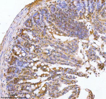 Immunohistochemical staining of PAFAH1B2 using anti-PAFAH1B2 antibody. PAFAH1B2 was detected in a paraffin-embedded section of mouse colon tissue. Heat mediated antigen retrieval was performed in EDTA buffer (pH 8.0, epitope retrieval solution). The tissue section was blocked with 10% goat serum. The tissue section was then incubated with 2 ug/ml rabbit anti-PAFAH1B2 antibody overnight at 4oC. Peroxidase Conjugated Goat Anti-rabbit IgG was used as secondary antibody and incubated for 30 min at 37oC.