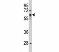 Western blot analysis of Src antibody and HepG2 lysate. Predicted size 55~60 kDa