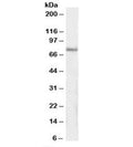 Western blot testing of human pancreas lysate with IP3KC antibody at 1ug/ml. Predicted/observed molecular weight: ~75kDa.