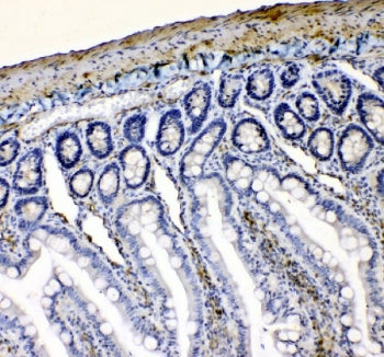 IHC staining of FFPE rat intestine tissue with VASP antibody. HIER: boil tissue sections in pH8 EDTA for 20 min and allow to cool before testing.
