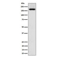 Western blot testing of human A673 cell lysate with ZFYVE9 antibody. Predicted molecular weight ~156 kDa.