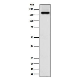 Western blot testing of human A673 cell lysate with ZFYVE9 antibody. Predicted molecular weight ~156 kDa.