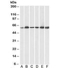 Western blot testing of human A) heart, B) kidney, C) liver lysates and pig D) heart, E) kidney, F) liver lysates using HSP60 antibody at 0.03ug/ml. Predicted molecular weight: ~61 kDa.