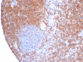 IHC staining of FFPE human tonsil tissue with CD6 antibody (clone rC6/372). HIER: boil tissue sections in pH 9 10mM Tris with 1mM EDTA for 20 min and allow to cool before testing.