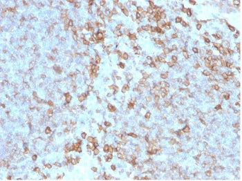 IHC staining of FFPE human tonsil tissue with CD27 antibody (clone LPFS2/4176). HIER: boil tissue sections in pH 9 10mM Tris with 1mM EDTA for 20 min and allow to cool before testing.