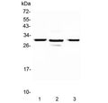 Western blot testing of 1) rat pancreas, 2) mouse pancreas and 3) human U-2 OS lysate with MED8 antibody at 0.5ug/ml. Expected molecular weight: 29-32 kDa.