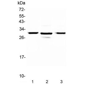 Western blot testing of 1) rat pancreas, 2) mouse pancreas and 3) human U-2 OS lysate with MED8 antibody at 0.5ug/ml. Expected molecular weight: 29-32 kDa.