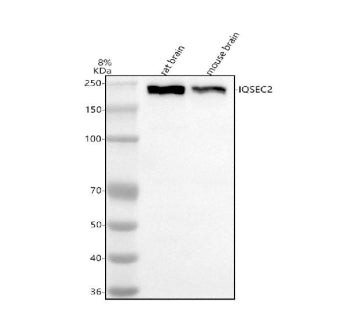 Western blot analysis of IQSEC2 using anti-IQSEC2 antibody. Electrophoresis was performed on a 8% SDS-PAGE gel at 80V (Stacking gel) / 120V (Resolving gel) for 2 hours. Lane 1: rat brain tissue lysates, Lane 2: mouse brain tissue lysates. After electrophoresis, proteins were transferred to a nitrocellulose membrane at 150 mA for 50-90 min. Blocked the membrane with 5% non-fat milk/TBS for 1.5 hour at RT.