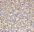 IHC staining of zebrafish Srebf1 protein using Zebrafish Srebf1 antibody, HRP-labeled secondary and DAB substrate. Srebf1 was detected in a paraffin-embedded section of zebrafish liver tissue. HIER: boil tissue sections in pH8 EDTA for 20 min and allow to cool before testing.
