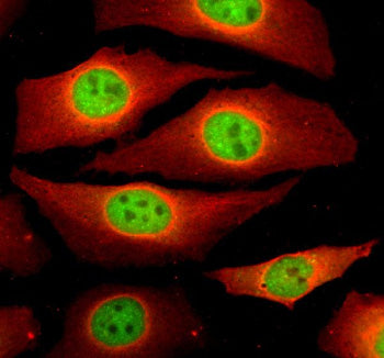 Immunofluorescent staining of NCAPG using anti-NCAPG antibody (green) and anti-Beta Tubulin antibody (red). NCAPG was detected in an immunocytochemical section of Hela cells. Enzyme antigen retrieval was performed using IHC enzyme antigen retrieval reagent for 15 mins. The cells were blocked with 10% goat serum. And then incubated with 5 ug/ml rabbit anti-NCAPG antibody and mouse anti-Beta Tubulin antibody overnight at 4oC.