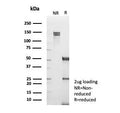 SDS-PAGE analysis of purified, BSA-free TNFR-Associated Factor 1 antibody (clone TRAF1/3365) as confirmation of integrity and purity.