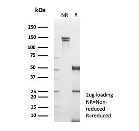 SDS-PAGE analysis of purified, BSA-free TNFR-Associated Factor 1 antibody (clone TRAF1/3365) as confirmation of integrity and purity.