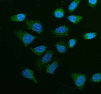 Immunofluorescent staining of OSBPL5 using anti-OSBPL5 antibody (green). OSBPL5 was detected in an immunocytochemical section of HELA cells. Enzyme antigen retrieval was performed using IHC enzyme antigen retrieval reagent for 15 mins. The cells were blocked with 10% goat serum. And then incubated with 5 ug/ml rabbit anti-OSBPL5 antibody overnight at 4oC. DyLight 488 Conjugated Goat Anti-Rabbit IgG was used as secondary antibody at 1:500 dilution and incubated for 30 min at 37oC.