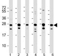 Western blot testing of human 1) HeLa, 2) HepG2, 3) Jurkat, 4) Raji, 5) 293 and 6) 293T/17 cell lysate with PCMT1 antibody at 1:2000. Predicted molecular weight: 25 kDa.