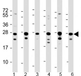 Western blot testing of human 1) HeLa, 2) HepG2, 3) Jurkat, 4) Raji, 5) 293 and 6) 293T/17 cell lysate with PCMT1 antibody at 1:2000. Predicted molecular weight: 25 kDa.