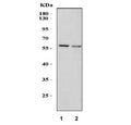 Western blot testing of 1) rat liver and 2) mouse liver lysate with SMAD5 antibody. Expected molecular weight: 52~60 kDa.