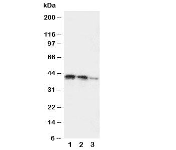 Western blot testing of DDR2 antibody and Lane 1: recombinant human protein 10ng; 2: 5ng; 3: 2.5ng