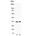 Western blot testing of IL-1b antibody and Lane 1: rat spleen; 2: rat thymus; Predicted molecular weight ~31 kDa.