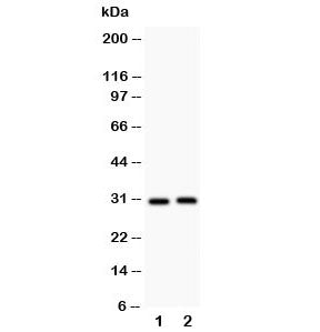 Western blot testing of IL-1b antibody and Lane 1: rat spleen; 2: rat thymus; Predicted molecular weight ~31 kDa.