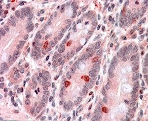 IHC testing of FFPE human small intestine with GNAT3 antibody at 4ug/ml. HIER: steamed with pH6 citrate buffer, AP-staining. Staining of endocrine cells amongst the enterocytes is seen.