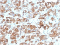 IHC staining of FFPE human pituitary tissue with LH beta antibody (clone rLHb/1613). HIER: boil tissue sections in pH 9 10mM Tris with 1mM EDTA for 20 min and allow to cool before testing.