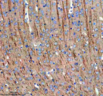 Immunohistochemical staining of MAP1B using anti-MAP1B antibody. MAP1B was detected in a paraffin-embedded section of mouse brain tissue. Heat mediated antigen retrieval was performed in EDTA buffer (pH 8.0, epitope retrieval solution). The tissue section was blocked with 10% goat serum. The tissue section was then incubated with 2 ug/ml rabbit anti-MAP1B antibody overnight at 4oC. Peroxidase Conjugated Goat Anti-rabbit IgG was used as secondary antibody and incubated for 30 min at 37oC.