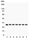 Western blot testing of Galectin 3 antibody and mouse samples 1: kidney; 2: liver; 3: spleen; 4: ovary; 5: HEPA; 6: ANA-1; 7: NIH3T3 lysate. Predicted/observed molecular weight ~26kDa