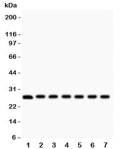 Western blot testing of Galectin 3 antibody and mouse samples 1: kidney; 2: liver; 3: spleen; 4: ovary; 5: HEPA; 6: ANA-1; 7: NIH3T3 lysate. Predicted/observed molecular weight ~26kDa