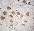 KCNRG antibody analysis in formalin fixed and paraffin embedded human brain tissue.