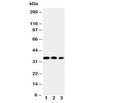 Western blot testing of HOXA4 antibody and Lane 1: SW620; 2: SW620; 3: PC-12 cell nuclear lysate. Predicted molecular weight: ~35kDa.