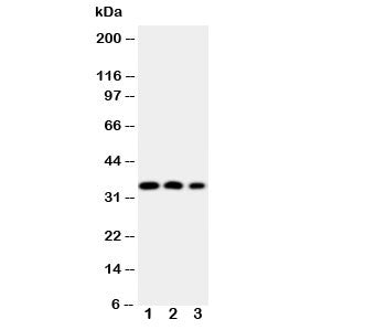 Western blot testing of HOXA4 antibody and Lane 1: SW620; 2: SW620; 3: PC-12 cell nuclear lysate. Predicted molecular weight: ~35kDa.