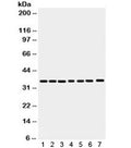 Western blot testing of 1) rat spleen, 2) rat stomach, 3) human HeLa, 4) 22RV1, 5) A549, 6) MCF7 and 7) SW620 antibody with Annexin A3 antibody. Predicted/observed molecular weight ~36 kDa.