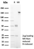 SDS-PAGE analysis of purified, BSA-free Alpha-2-Macroglobulin antibody (clone A2M/4848) as confirmation of integrity and purity.