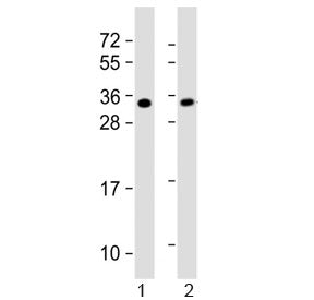 Western blot testing of 1) mouse heart and 2) rat PC-12 lysate with SLUG antibody. Predicted molecular weight ~30 kDa.