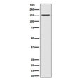 Western blot testing of human K562 cell lysate with NKCC2 antibody. Expected molecular weight: 121-160 kDa depending on glycosylation level. It can also be observed as an ~300 kDa complex with NKCC1.