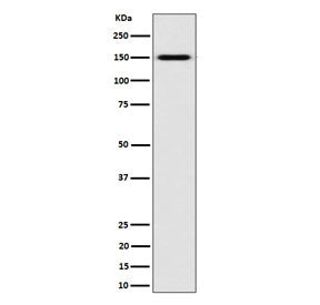 Western blot testing of human K562 cell lysate with NKCC2 antibody. Expected molecular weight: 121-160 kDa depending on glycosylation level. It can also be observed as an ~300 kDa complex with NKCC1.