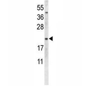 Western blot analysis of Neurophysin 1 antibody and MDA-MB231 lysate. Predicted molecular weight ~12 kDa.