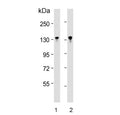 Western blot testing of human 1) Jurkat and 2) MOLT4 cell lysate with BCL11B antibody. Predicted molecular weight ~96 kDa but the modified forms of the protein can be observed at ~130 kDa.