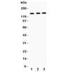 Western blot testing of IRS1 antibody and Lane 1: A549; 2: MM453; 3: Jurkat. Expected size: 132~185KD depending on serine phosphorylation level