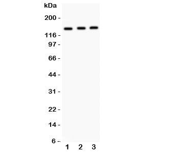 Western blot testing of IRS1 antibody and Lane 1: A549; 2: MM453; 3: Jurkat. Expected size: 132~185KD depending on serine phosphorylation level