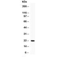 Western blot testing of 0.5ng/lane of rat IFNg recombinant protein with rat Interferon gamma antibody at 0.5ug/ml.