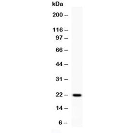 Western blot testing of 0.5ng/lane of rat IFNg recombinant protein with rat Interferon gamma antibody at 0.5ug/ml.