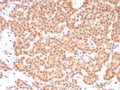IHC staining of FFPE human parathyroid tissue with c-RET antibody (clone RET/8790). HIER: boil tissue sections in pH 9 10mM Tris with 1mM EDTA for 20 min and allow to cool before testing.