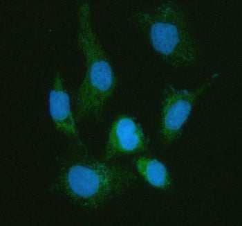 Immunofluorescent staining of MFAP3L using anti-MFAP3L antibody (green). MFAP3L was detected in an immunocytochemical section of human HELA cells. Enzyme antigen retrieval was performed using IHC enzyme antigen retrieval reagent for 15 mins. The cells were blocked with 10% goat serum. And then incubated with 5 ug/ml rabbit anti-MFAP3L antibody overnight at 4oC. DyLight 488 Conjugated Goat Anti-Rabbit IgG was used as secondary antibody at 1:500 dilution and incubated for 30 min at 37oC.