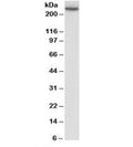 Western blot testing of human peripheral blood lymphocyte lysate with MYH9 antibody at 0.3ug/ml. Predicted molecular weight: ~227kDa.